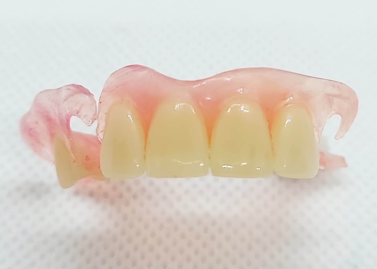 Flexible Partial Dentures – Dental Lab Direct