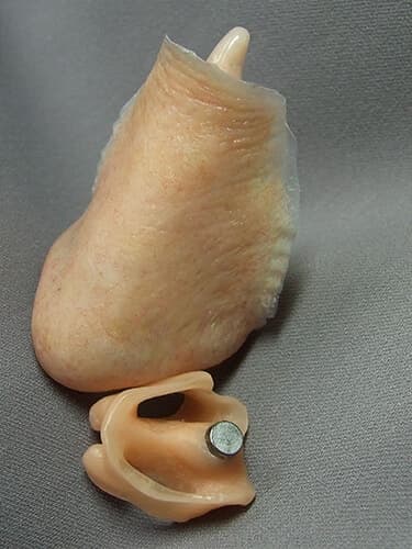 Lifesaving Prosthetic Nose: A California Man's Journey