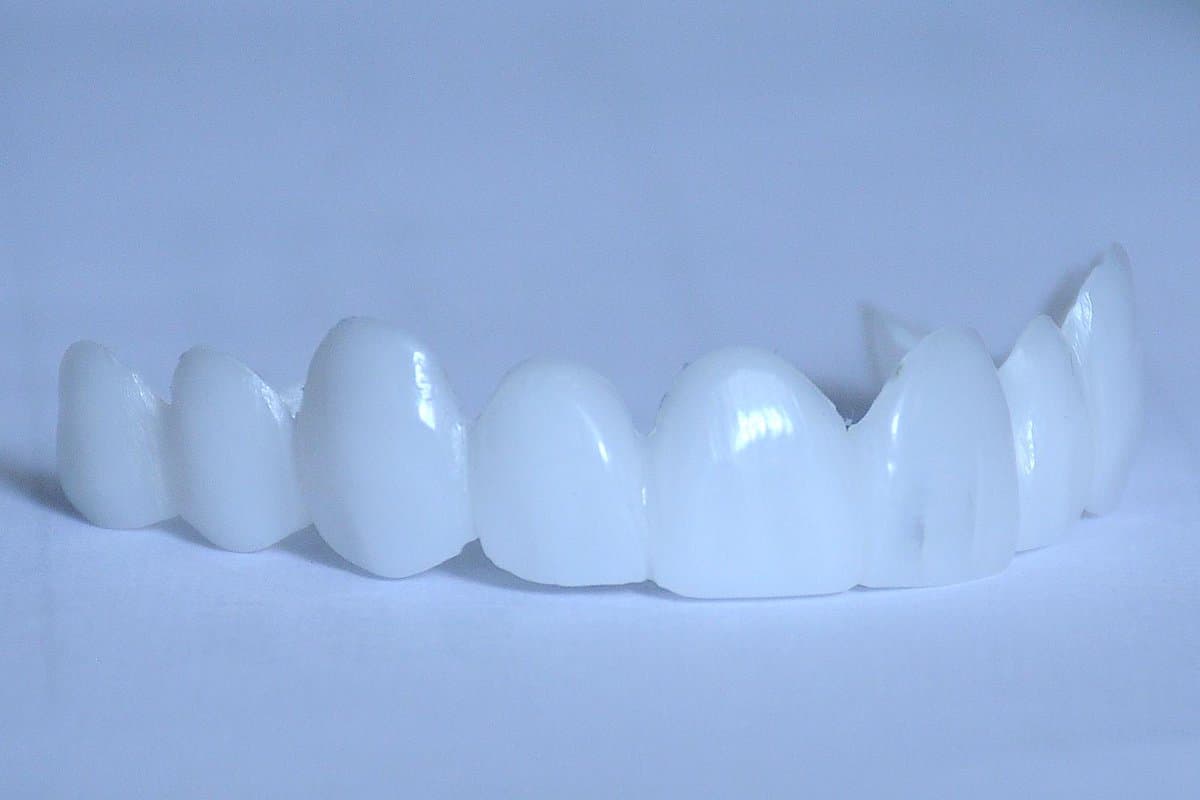 Alpha Veneers (@AlphaVeneers) | Twitter