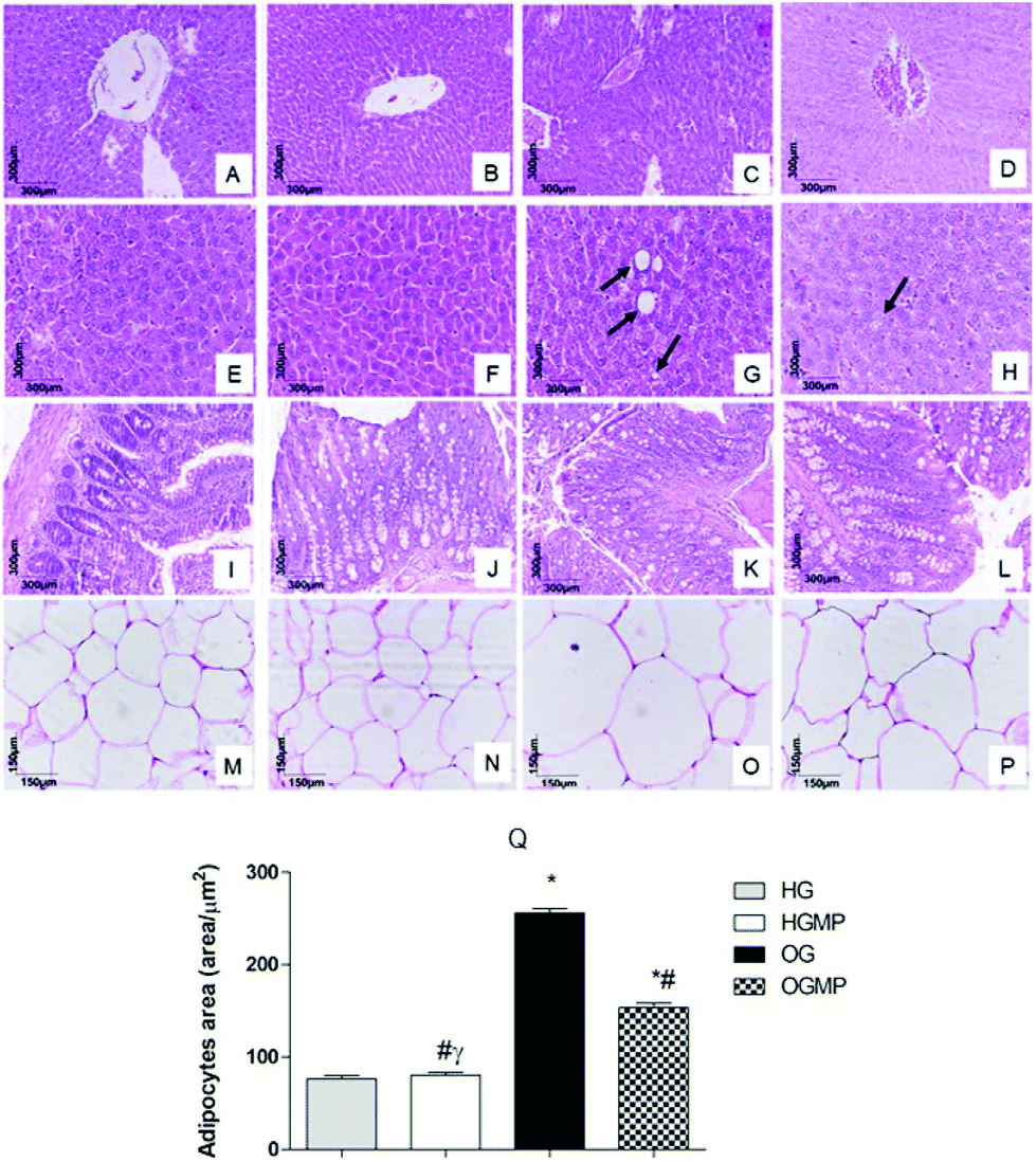 Mucuna pruriens treatment shows anti-obesity and intestinal health ...