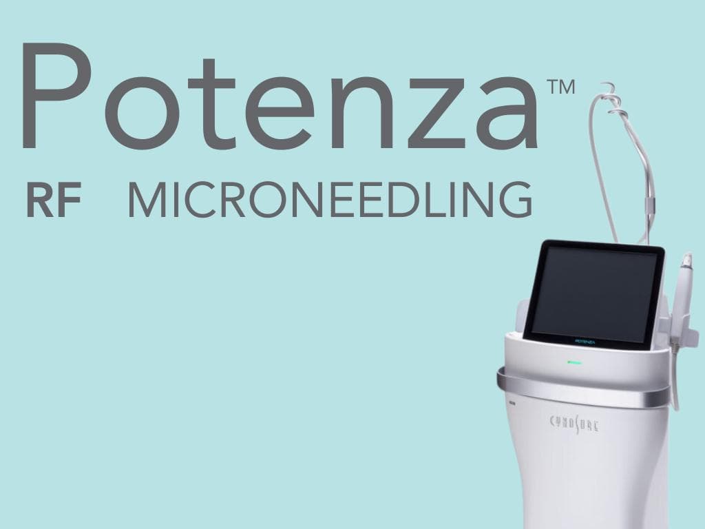 All You Need to Know About Potenza™ RF Microneedling - …