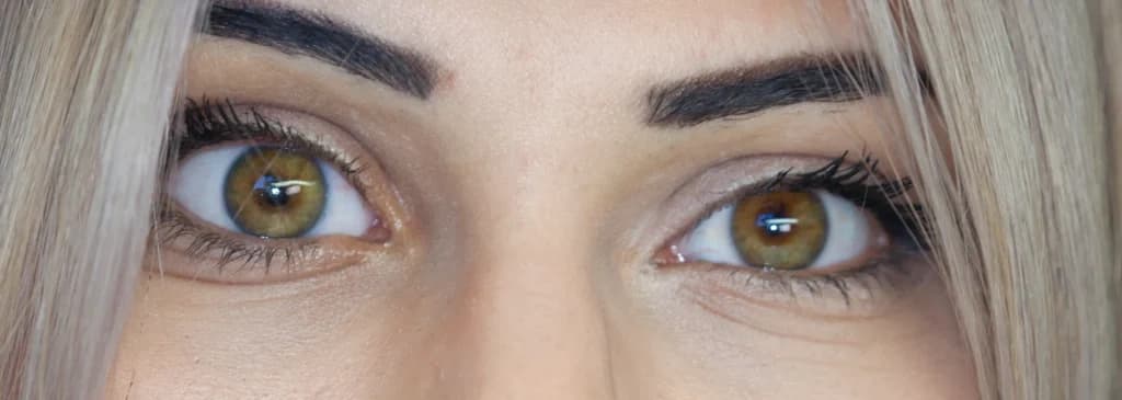 Vision with an ocular prosthesis - Advanced Artificial Eyes