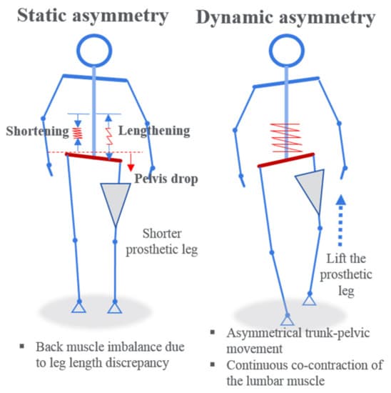 Intramuscular Properties of Resting Lumbar Muscles in Patients ...